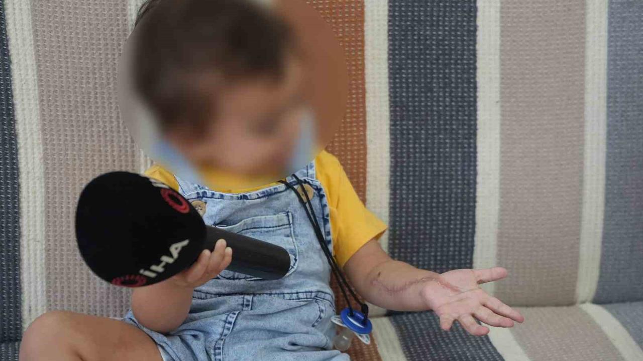 Iğdır'da 1,5 yaşındaki çocuğun tomografi sonrası iki operasyon geçirdiği ve kolunda hasar oluştuğu iddia edildi.